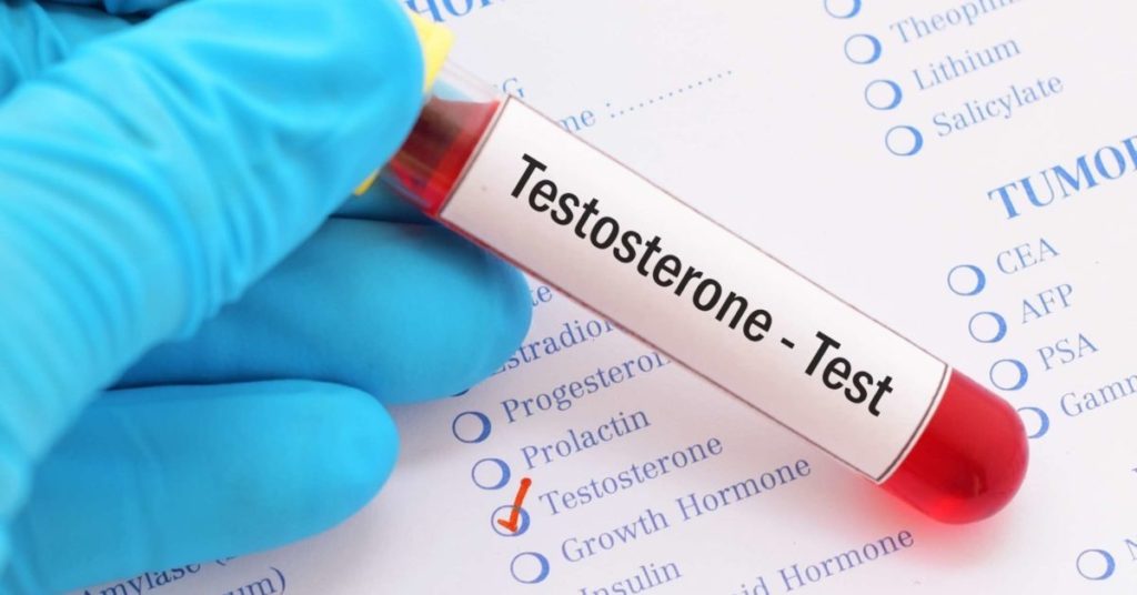 testosterone levels